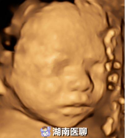 孕检四维五维,怀孕做了四维还要做二维三维吗