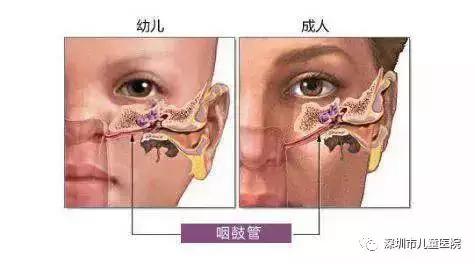 5岁孩子感冒后鼻子里面发红肿大,小孩子发烧后耳朵后面长大包