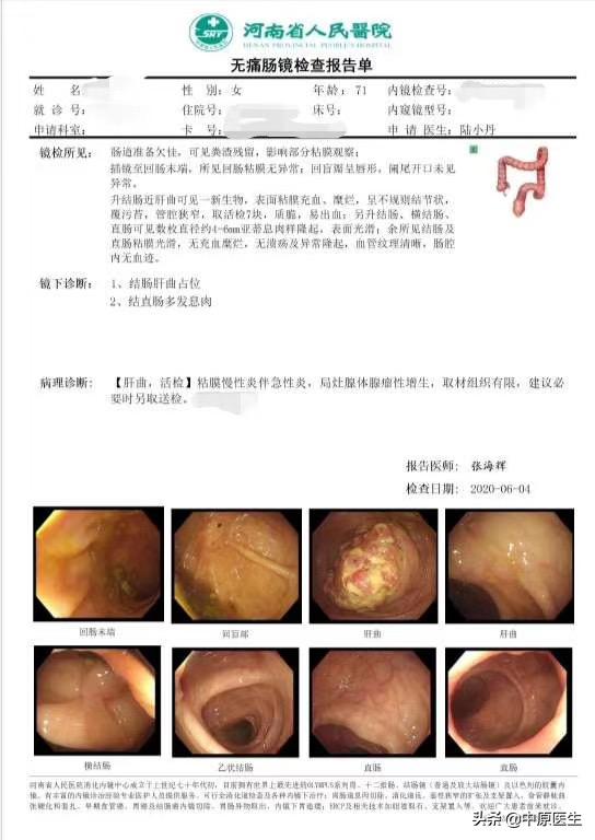 老人便血一年,70岁老人便血两年不去治能活多久