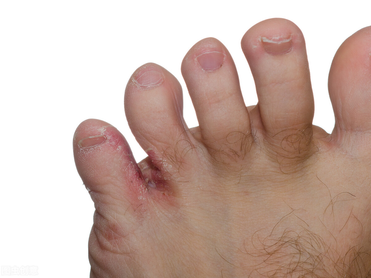 皮肤瘙痒止痒5大偏方帮你止痒,皮肤病痒怎么止痒效果好