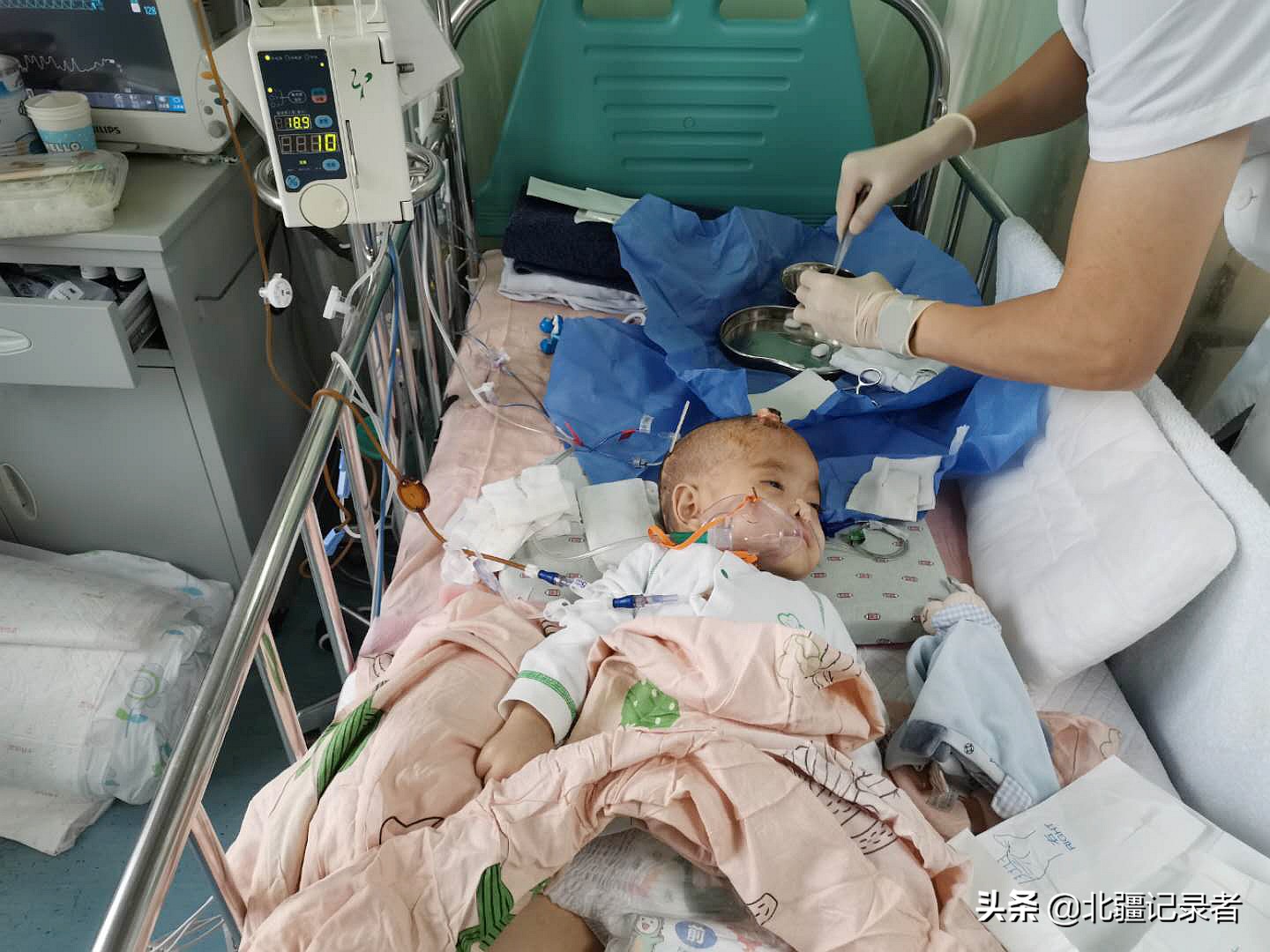 罕见病泡泡男孩,泡泡男童