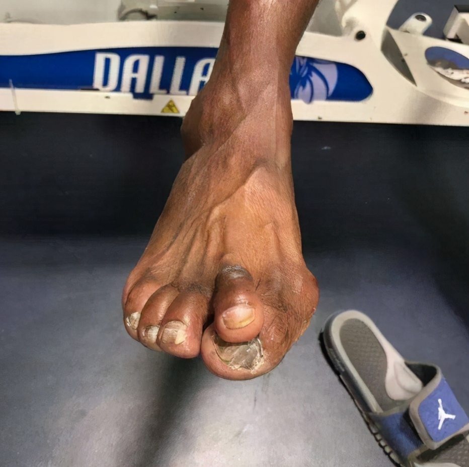 看了球员战脚还羡慕他们高薪资？老詹脚似外星人，大胡子脚像怪兽