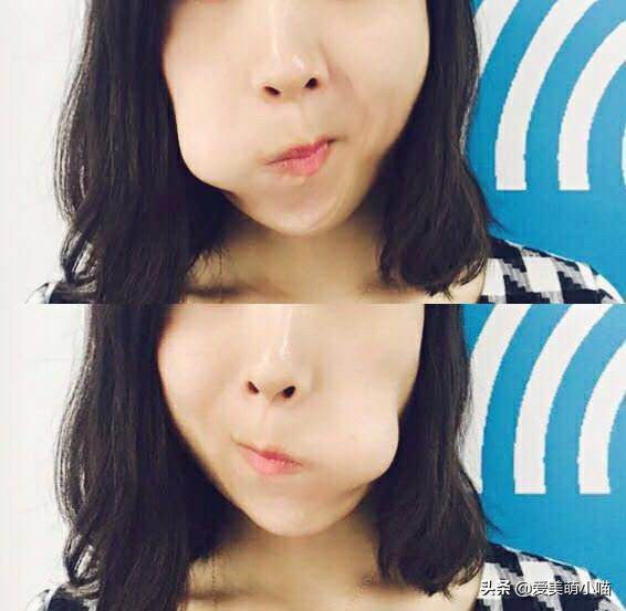 法令纹深有什么拯救方法,减肥脸上出现法令纹怎么拯救