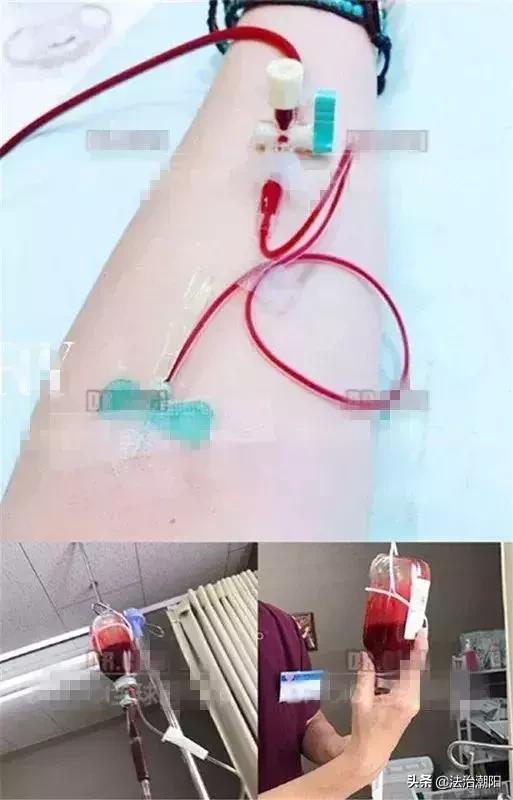 女性洗护流程,洗血美容法真的有效吗