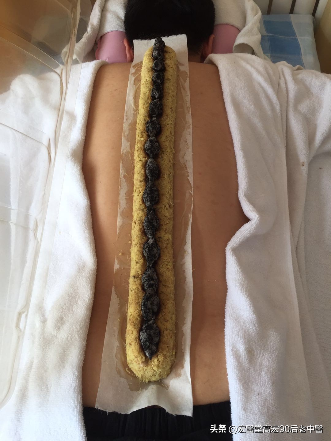 阳虚阳气不足的表现,阳虚怕冷的六种表现