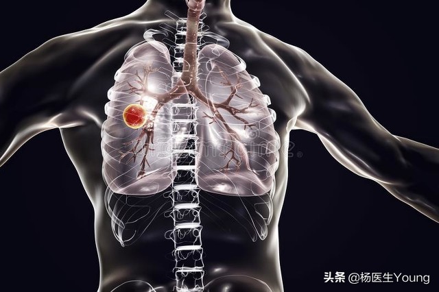 南京新冠病例基本都接种了疫苗，为何还会被感染？疫苗还有用吗？