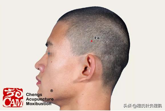 面瘫面神经炎中医调理方法,面神经炎中医针灸穴位图片
