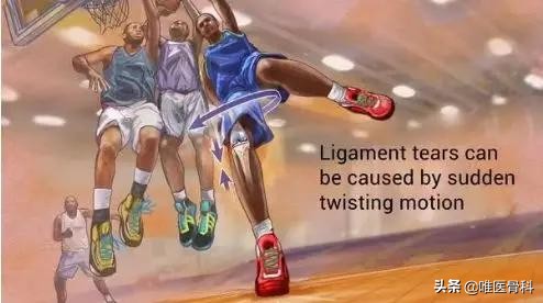 怎么判断交叉韧带损伤,膝关节交叉韧带损伤专家