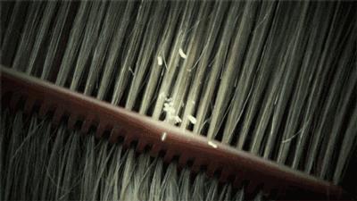 掌握这四点轻松拥有领导力,分享一下去屑经验