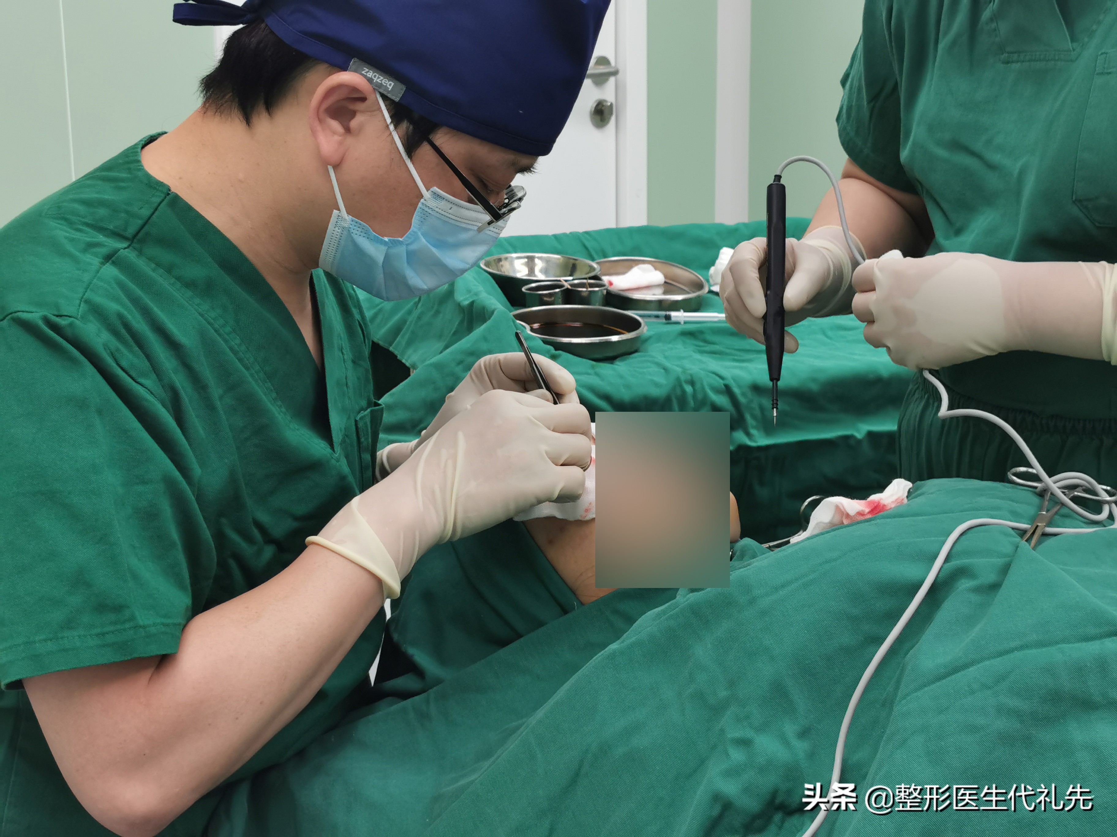 年轻时精致的单眼皮,过了30岁松弛变形,如何进行眼睛美丽年轻化