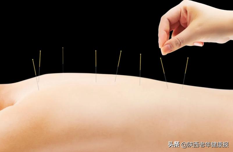 如何学针灸减肥知识点总结,健康大讲堂针灸减肥