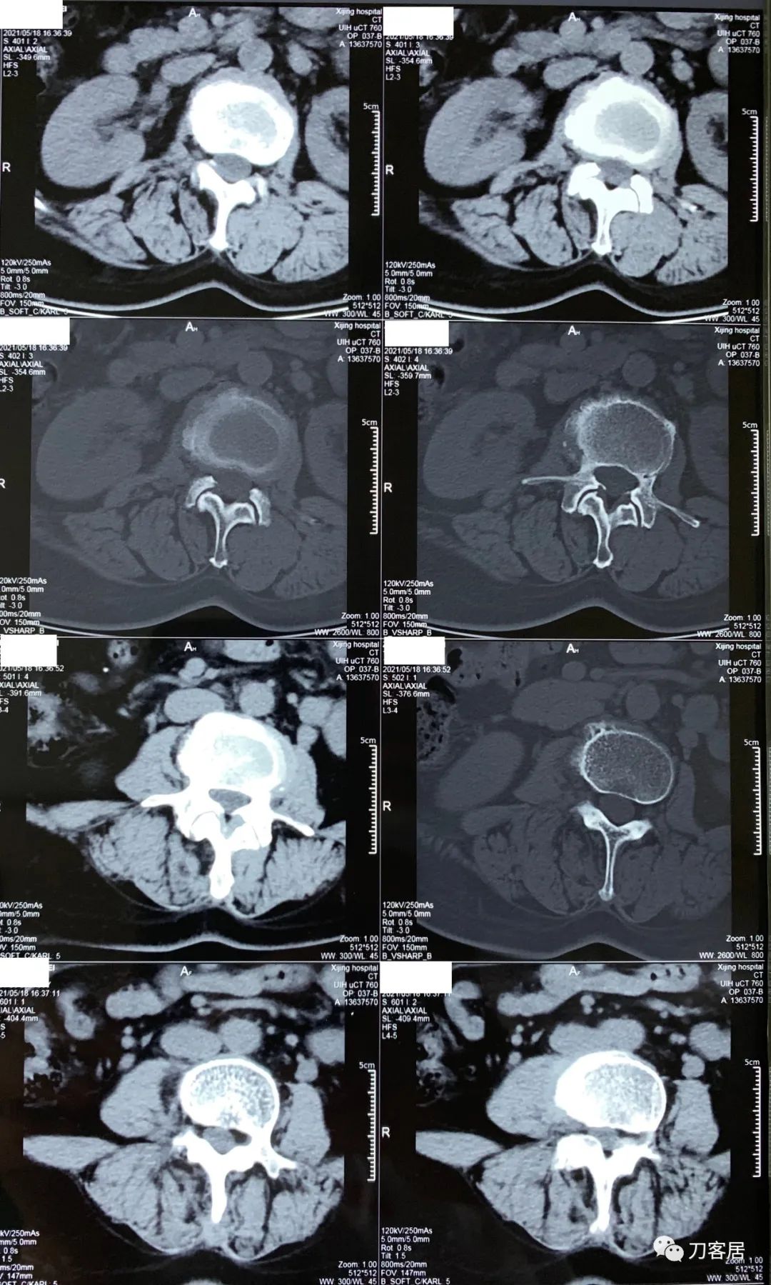 我的门诊病历,我的门诊
