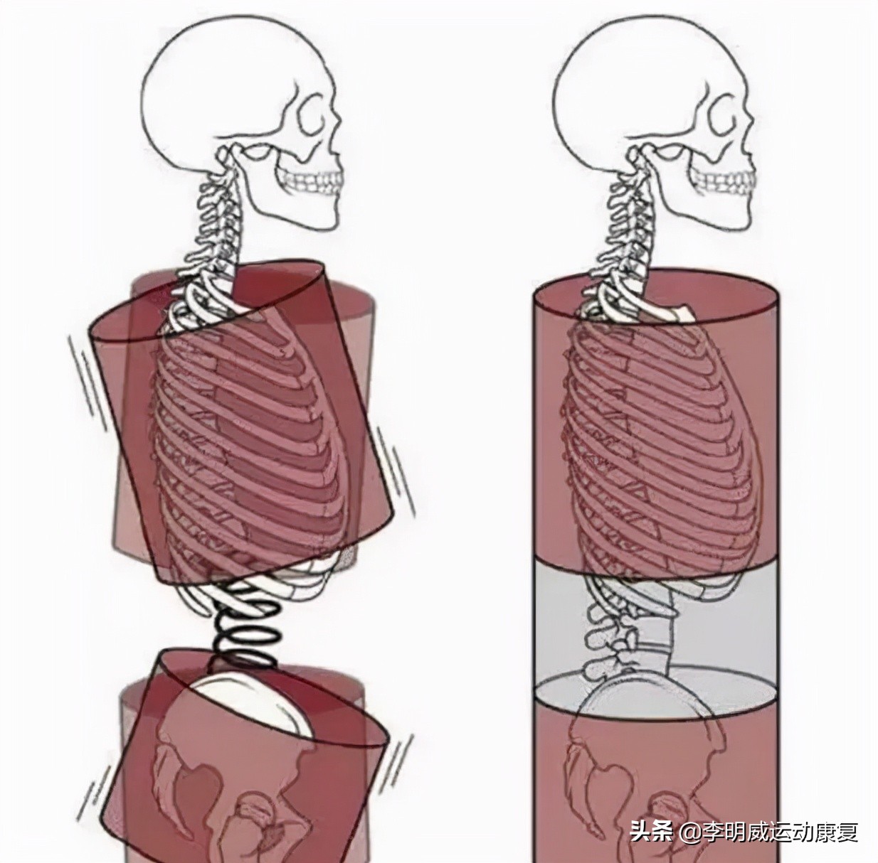 骨盆前倾骨盆不正怎么恢复,骨盆不正会造成什么后果