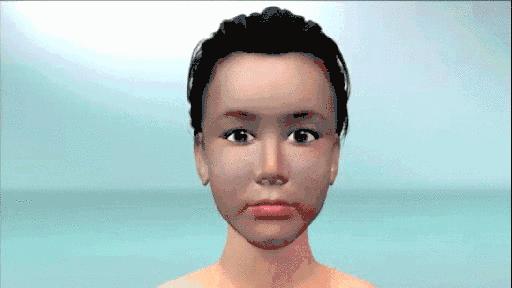 线雕后想做拉皮能剥离吗,做了线雕是不是要剥离再做小拉皮