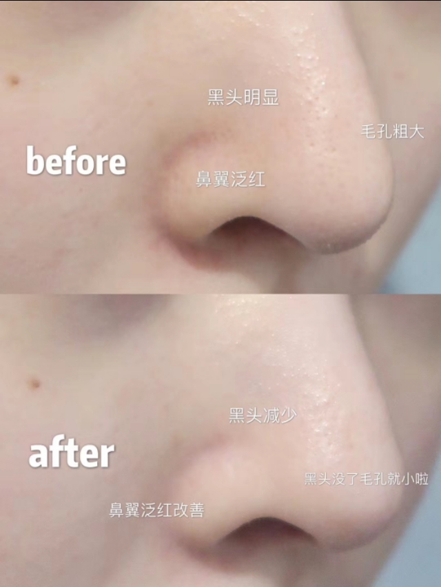 科颜氏男士产品怎么样,国产科颜氏十大必买产品