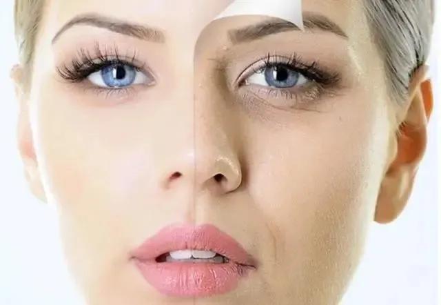 韦敏科普丨哪些原因会导致法令纹出现