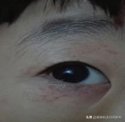 皮肤病科普系列,皮肤病科普素材