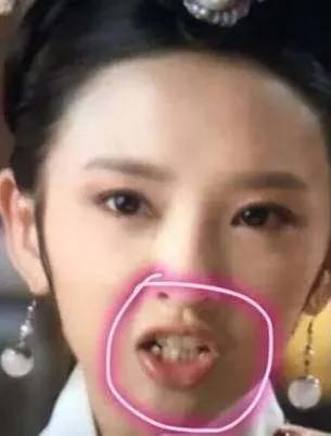 明星整牙前后对比,龅牙明星整牙前后的惊人变化