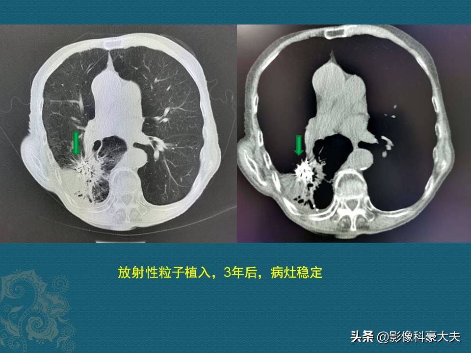 老人病了医生说治不好怎么办,老人有病治不好了要不要告诉他