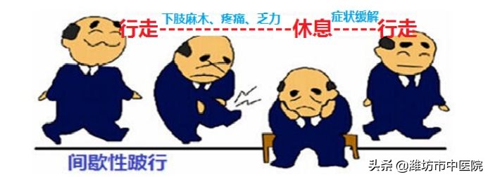 针灸治疗腰椎间盘突出几次有效果,针灸女性腰椎间盘突出视频观看