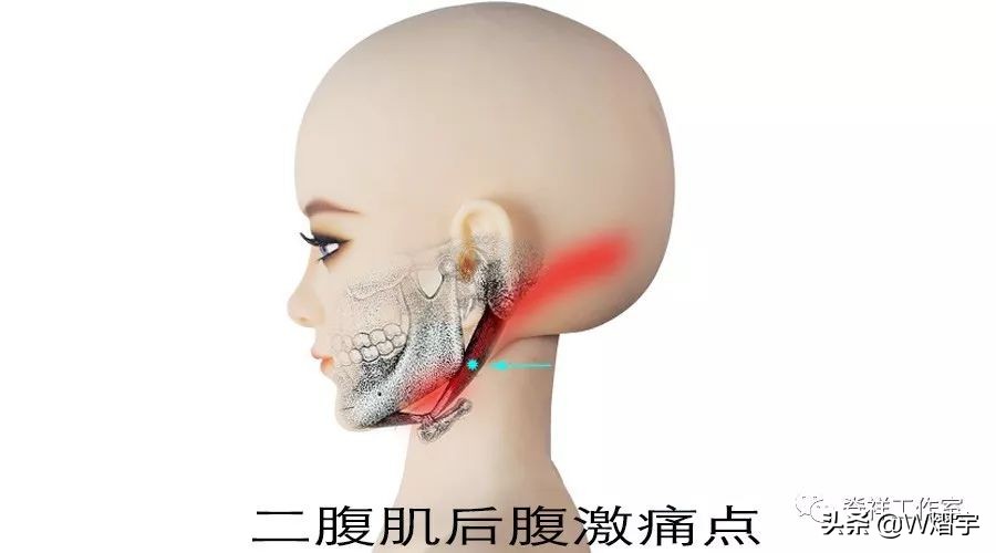 吞咽痛并有痰是什么原因,吞咽时舌下疼怎么办