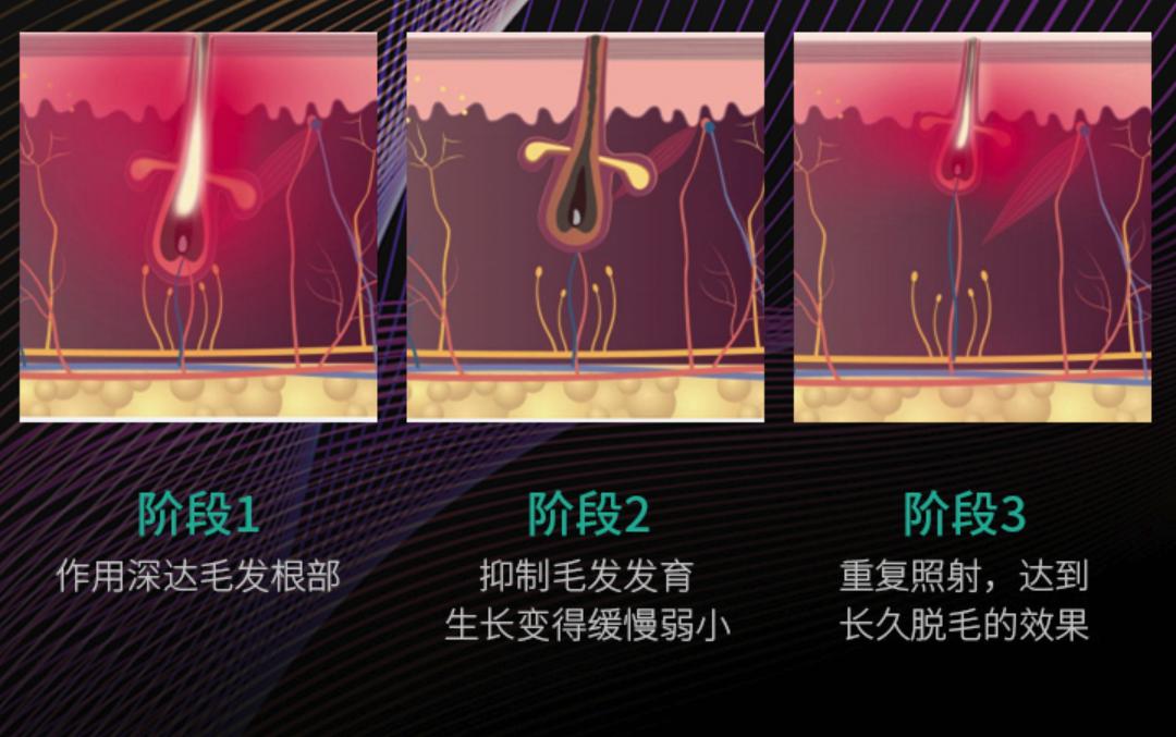 给大伙测评六款热门脱毛仪,opt脱毛仪哪种最好