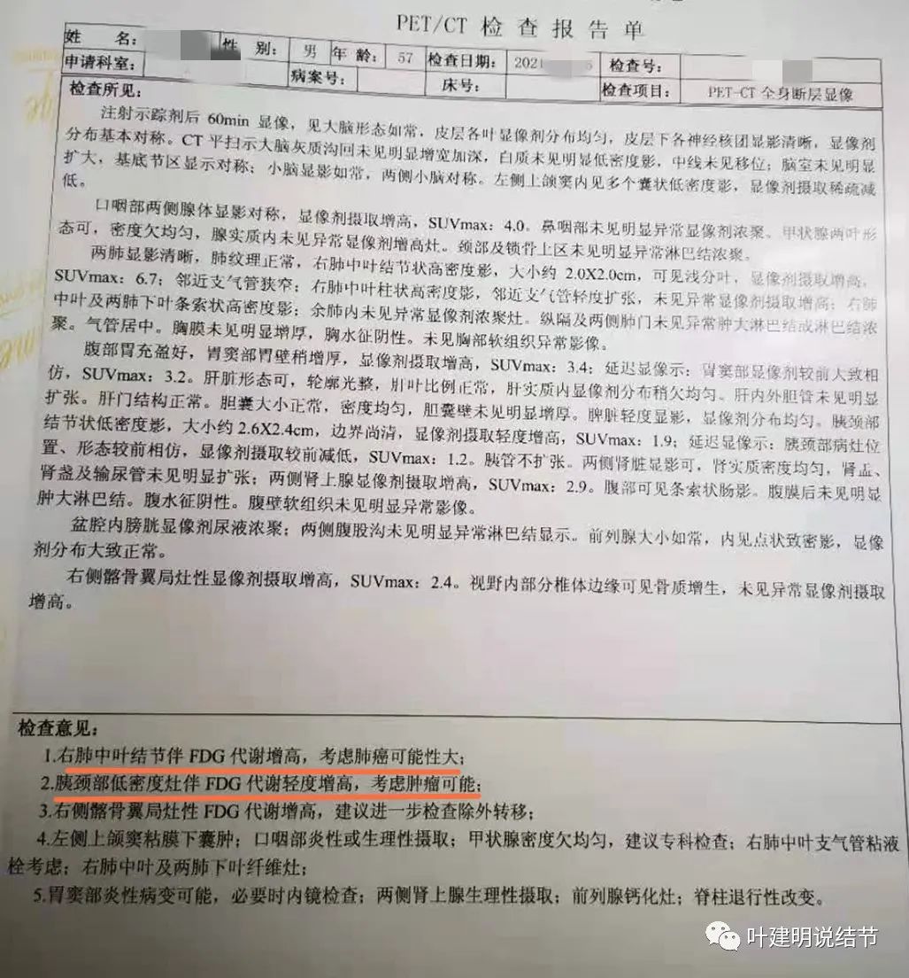 实性结节影要不要紧,实性结节穿刺活检为良性