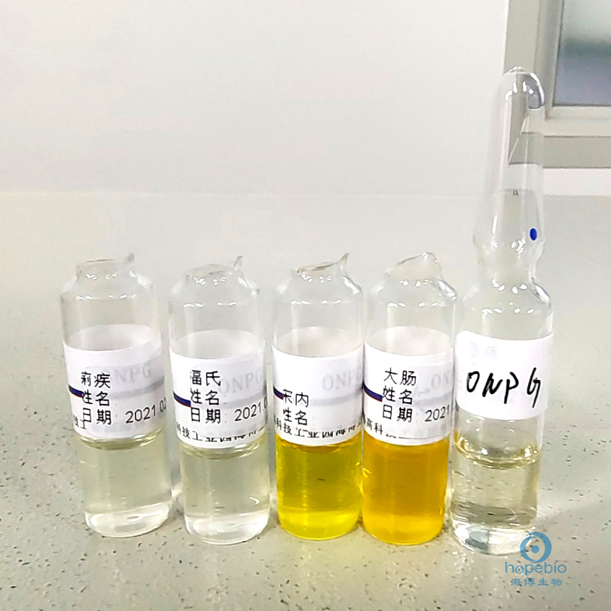 食品中志贺氏菌的检测,志贺氏菌检测标准值是不得检出吗