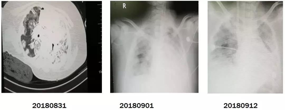 陈荣昌在哪个医院,陈荣昌广州呼吸疾病研究所所长