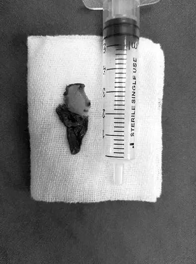 可怕小女孩吃东西,可怕的小女孩吃美食