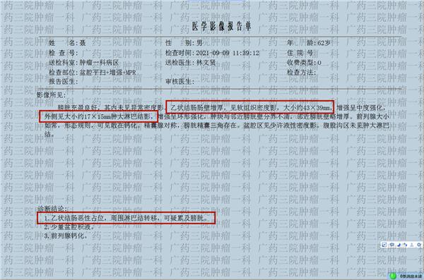 广药三院肿瘤成功案例,广药三院癌症中心