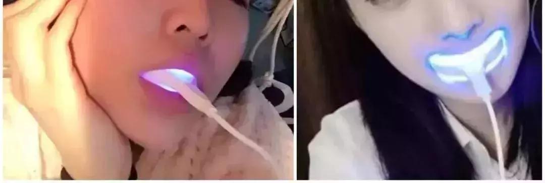 抖音上的美牙神器有用吗,使用美牙仪的抖音网红