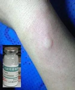 青霉素的注意事项有哪些,青霉素能治什么病害