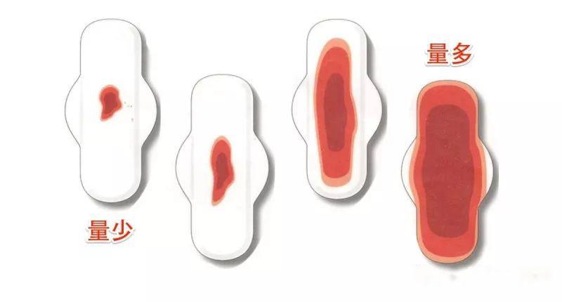 女性月经量太大是什么原因,月经量过大怎么处理