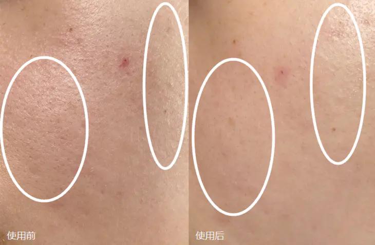 会拉丝的面膜,适合小脸的提拉面膜