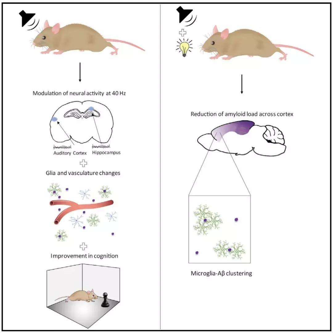 40赫兹预防老年痴呆音乐,新发现有望治疗阿尔茨海默病