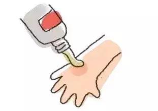 夏天蚊子喜欢咬原因,夏天蚊子为什么喜欢光