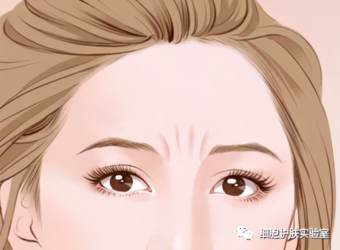 眉间皱纹怎么形成的,消除眉间皱纹抬头纹怎么去除