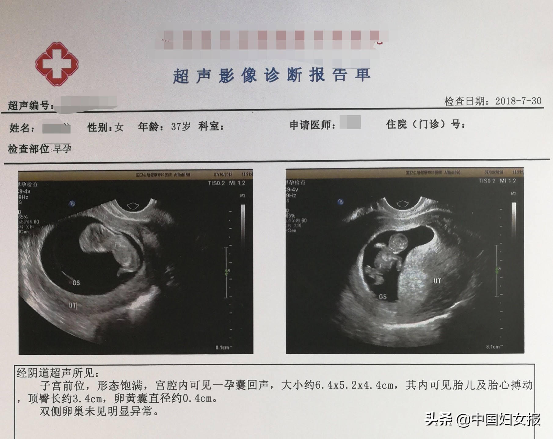 单身女性选精生子：我到美国买常青藤精子，生混血宝宝