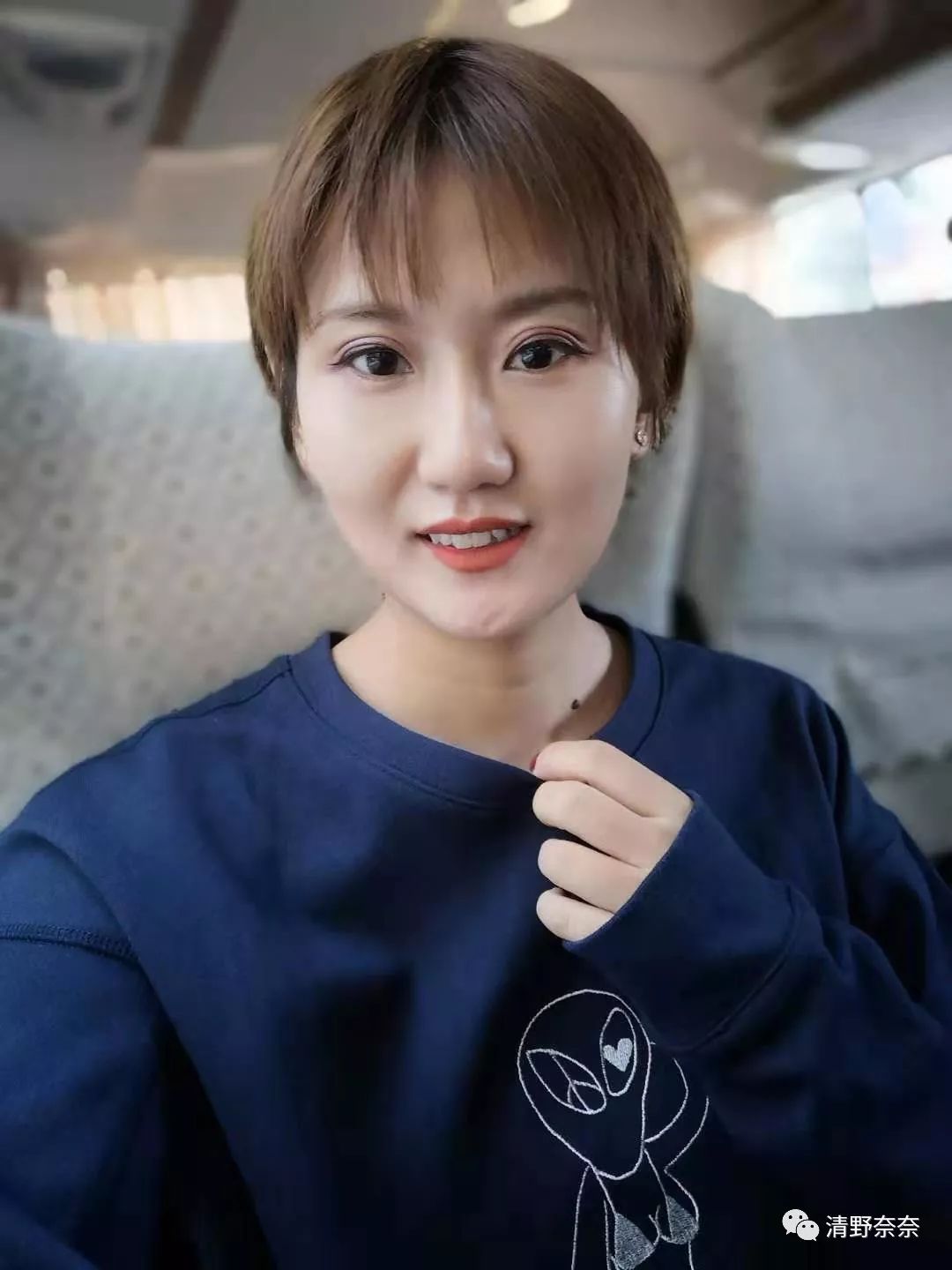 四十岁有法令纹川字纹医美项目,法令纹和鱼尾纹用医美怎么处理