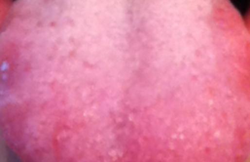 又上火了怎么回复,急火上火