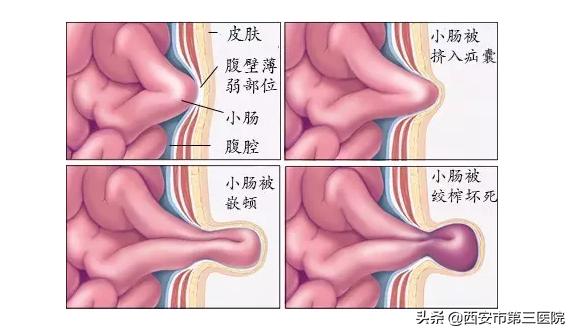 医者阅读答案及解析,医者解读