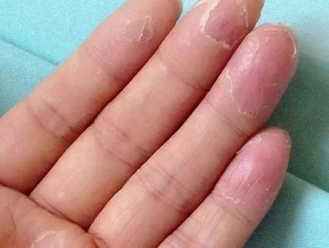 郑大一附院皮肤专家刘学伟,河南中医一附院皮肤科刘学伟