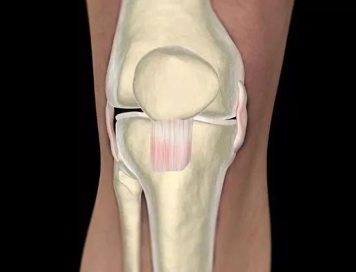 膝关节扭伤科普视频,膝关节损伤预防科普视频