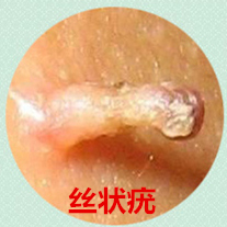 身上有不起眼的红点,身上有一点点小的痣