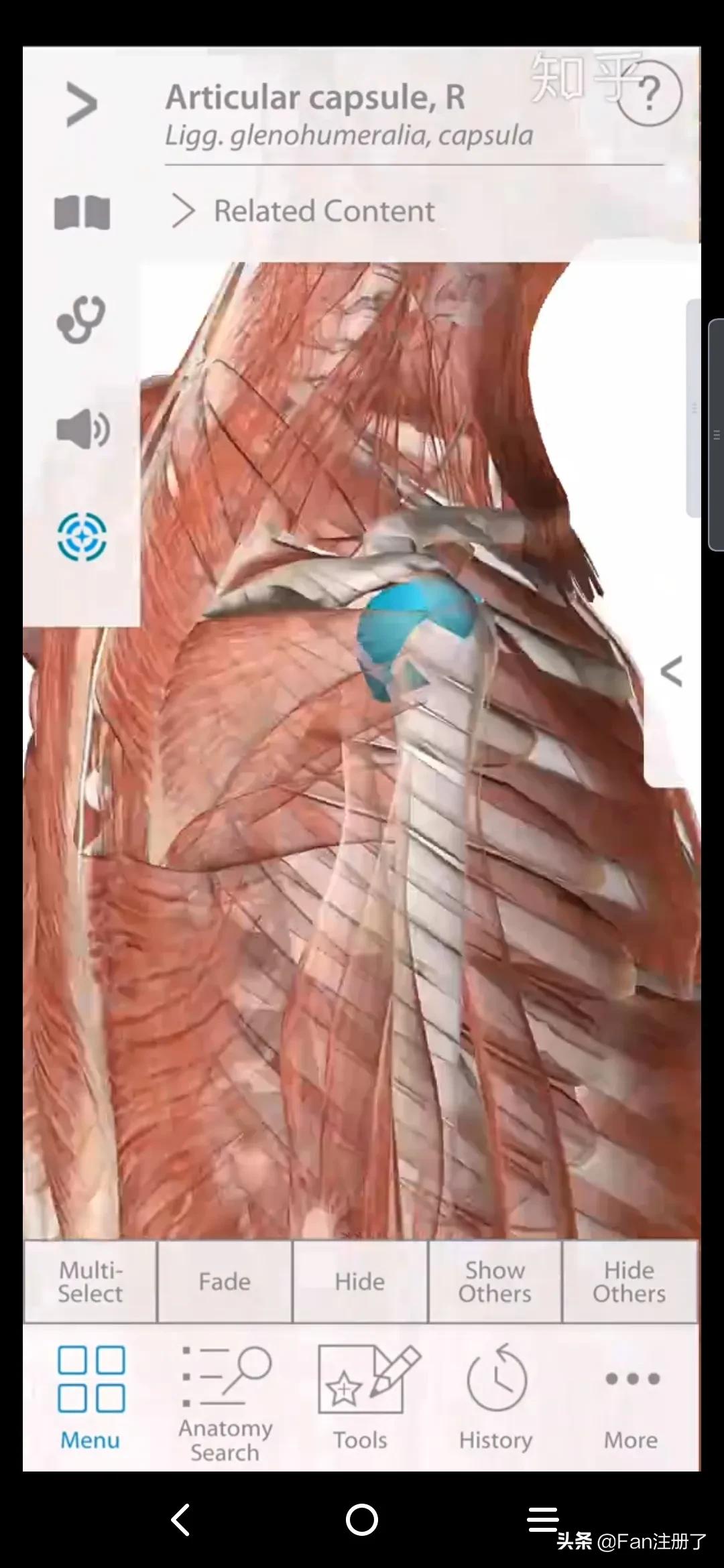 肩痛肩袖损伤针刀治疗,肩痛肩关节活动受限用什么药