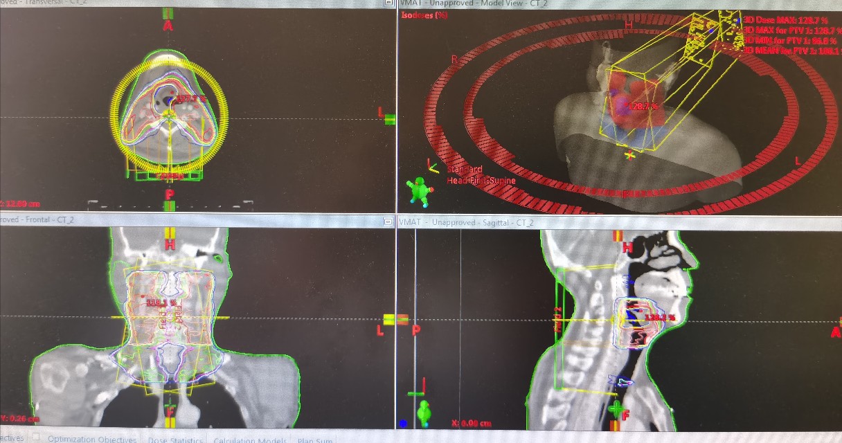 鼻咽癌放疗后吃什么食物最好,鼻咽癌放疗后脑损伤怎么恢复