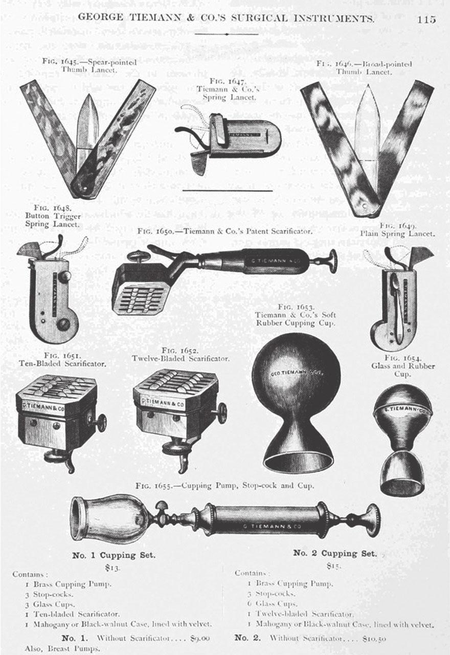 近代欧洲人曾将水蛭放入体内吸血——来治疗各种疾病