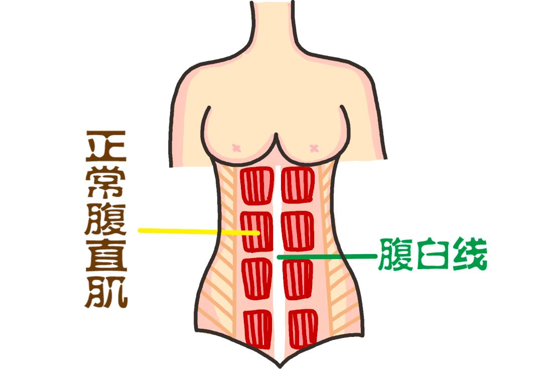 生完孩子我的水桶腰怎么办？