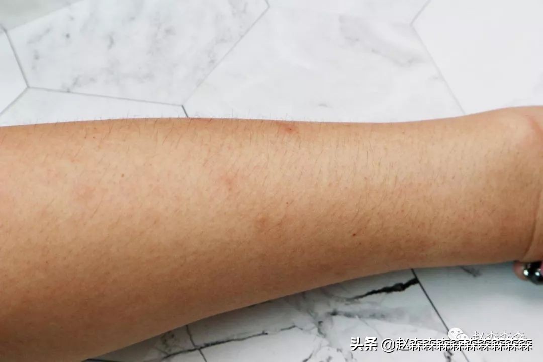 ulike激光脱毛仪使用感受,ulike脱毛仪真的可以永久脱毛吗